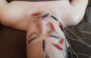 Châm cứu,Bấm huyệt tại nhà