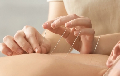 Cách châm cứu bấm huyệt chữa đau thần kinh tọa