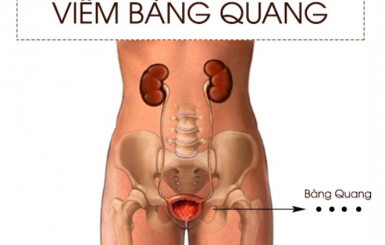Chữa viêm bàng quang bằng đông y