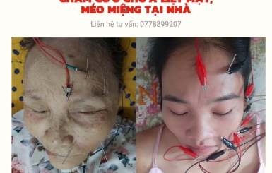 Dịch vụ bác sĩ đông y khám bệnh tại nhà TPHCM