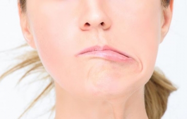 Chữa Liệt Dây Thần Kinh Số 7 Bằng Đông Y – Phục Hồi Tự Nhiên Không Cần Phẫu Thuật