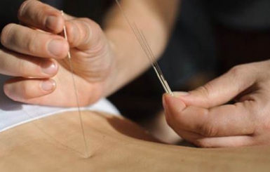 Cấy Chỉ Giảm Béo Bụng