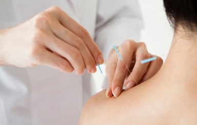 Tại sao nên thử châm cứu để giảm đau mà không sử dụng thuốc?