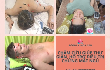 Châm cứu trị mất ngủ và châm cứu giảm béo tại Đông Y Hoa Sen