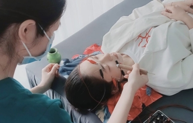Châm cứu chữa mất ngủ mãn tính – Giải pháp đông y giúp ngủ ngon tự nhiên