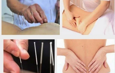 Châm Cứu Điều Trị Thoát Vị Đĩa Đệm