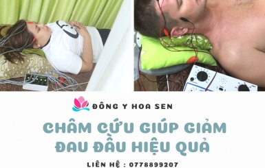 Châm Cứu Bấm Huyệt Chữa Đau Đầu Mất Ngủ Phần 2