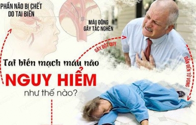 Châm Cứu Chữa Tai Biến