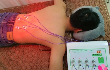 Châm Cứu Chữa Đau Thần Kinh Tọa