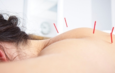 Bạn đã biết châm cứu được thực hiện như thế nào chưa?