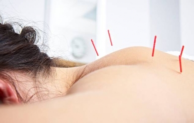Châm cứu nhiều có nguy hiểm đến sức khỏe?