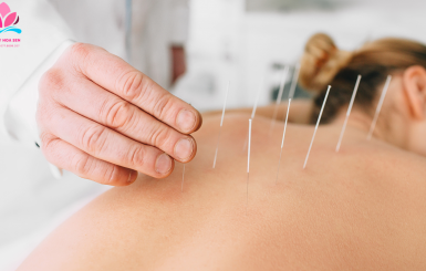 KHÓA HỌC CHÂM CỨU CƠ BẢN & NÂNG CAO