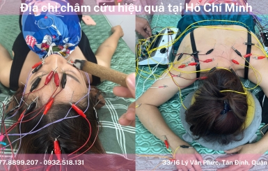 Đông Y Hoa Sen – Phòng khám châm cứu Sài Gòn chất lượng cao