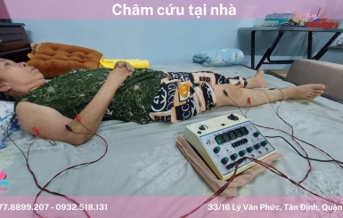 Đơn vị cung cấp dịch vụ châm cứu tại nhà hiệu quả