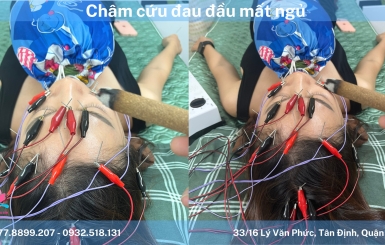 Chữa khỏi chứng mất ngủ nhờ y học cổ truyền