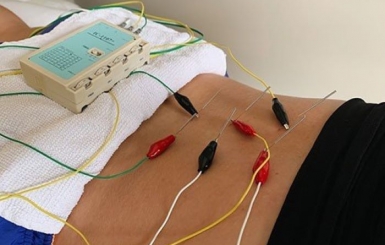 Đau dây thần kinh tọa: Nguyên nhân, triệu chứng và cách điều trị theo Đông Y