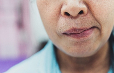 Điều trị liệt dây thần kinh số 7 bằng Đông Y