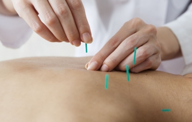 Cấy chỉ chữa đau vai gáy: Giải pháp Y học cổ truyền hiệu quả, an toàn, không dùng thuốc