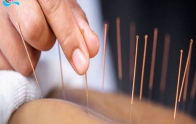 Địa chỉ châm cứu ở TPHCM nào mà khách hàng đánh giá cao?