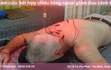 Địa chỉ châm cứu tốt nhất tại TPHCM – Tư vấn miễn phí!