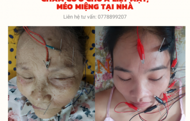 Địa chỉ chữa bệnh liệt dây kinh số 7 uy tín và hiệu quả