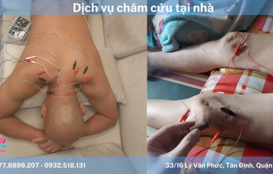 Trải nghiệm dịch vụ châm cứu bấm huyệt tại nhà TPHCM