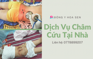 Dịch vụ châm cứu tại nhà | Giải pháp an toàn và tiện lợi