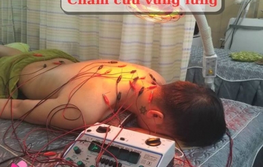 Điện châm có tác dụng gì đối với sức khỏe của người bệnh?