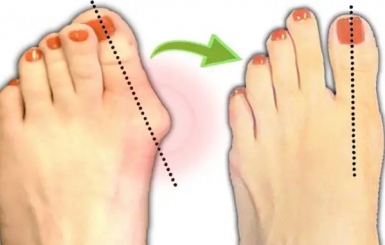 Viêm Đa Khớp: Nguyên Nhân, Triệu Chứng và Cách Điều Trị Hiệu Quả