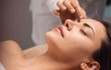 Châm Cứu Chữa Đau Đầu, Mất Ngủ – Giải Pháp Đông Y Hiệu Quả Và Lành Tính