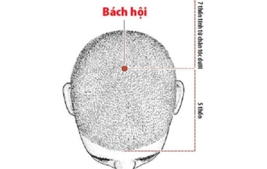 Cách bấm huyệt trị rối loạn tiền đình giảm chóng mặt cấp tốc