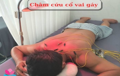 Những lợi ích chữa bệnh tuyệt vời khi bấm huyệt vùng vai gáy
