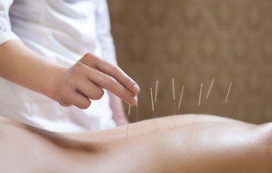 Châm Cứu Chữa Bệnh Đau Lưng – Giải Pháp An Toàn Từ Y Học Cổ Truyền