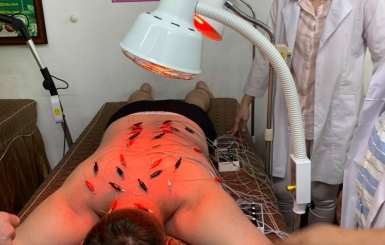 Nên châm cứu vào thời gian nào trong ngày?