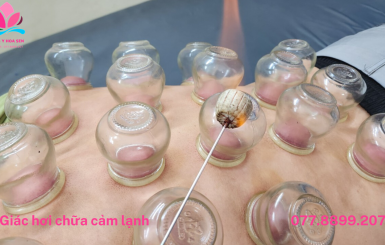 Đơn vị nhận cạo gió giác hơi TPHCM uy tín