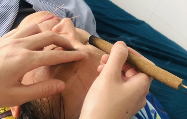 Phương pháp cứu ngải chữa đau lưng do hàn