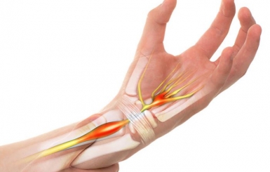 Tê bì tay chân có nguy hiểm không?