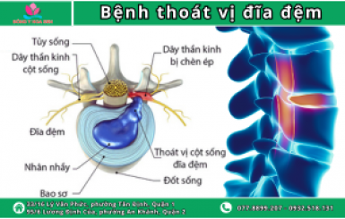 Hướng dẫn khám thoát vị đĩa đệm cột sống thắt lưng chi tiết