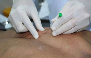 Thủy châm – Phương pháp chữa bệnh hiệu quả và an toàn từ Đông Y