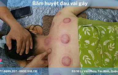 Trị liệu cổ vai gáy TPHCM – Đội ngũ y tế chuyên nghiệp và hiện đại