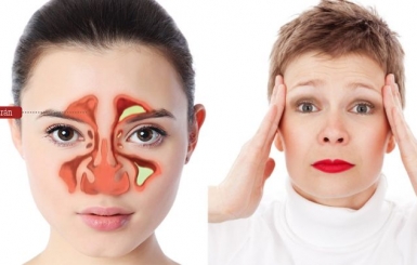 Y Học Cổ Truyền điều trị viêm xoang có khó không?