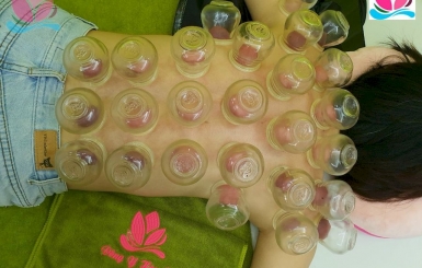 Cạo gió giác hơi có nguy hiểm không?