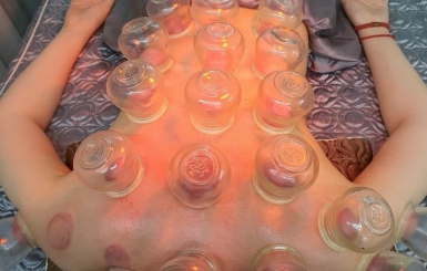 Khi nào nên cạo gió giác hơi?