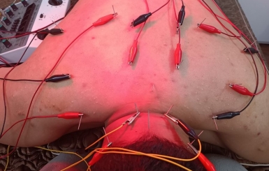 Châm cứu bấm huyệt quận 1 ở đâu?