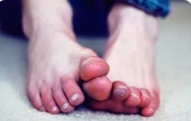 Chữa Lạnh Tay Chân Bằng Y Học Cổ Truyền: Giải Pháp Tự Nhiên, Lành Tính và Hiệu Quả