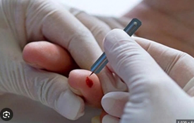 Chích Lễ Chữa Bệnh Gì? Địa Chỉ Chích Lễ Uy Tín Tại TP.HCM