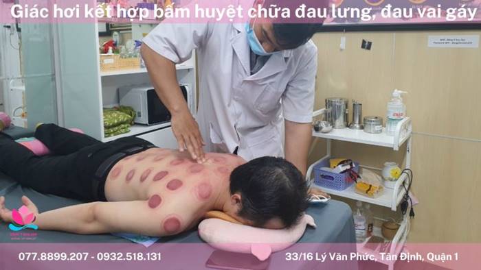 cạo gió giác hơi gần đây