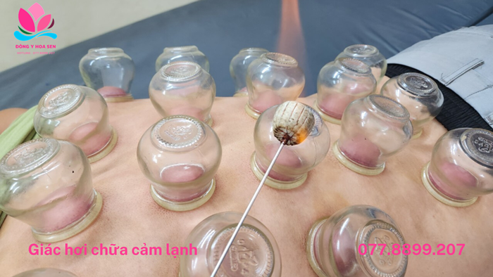 cạo gió giác hơi ở đâu