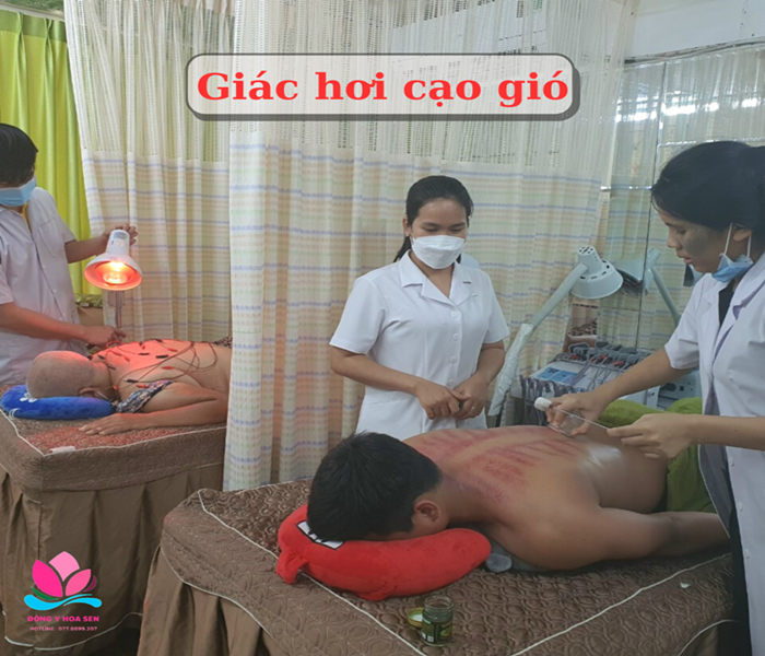 cạo gió giác hơi ở Sài Gòn