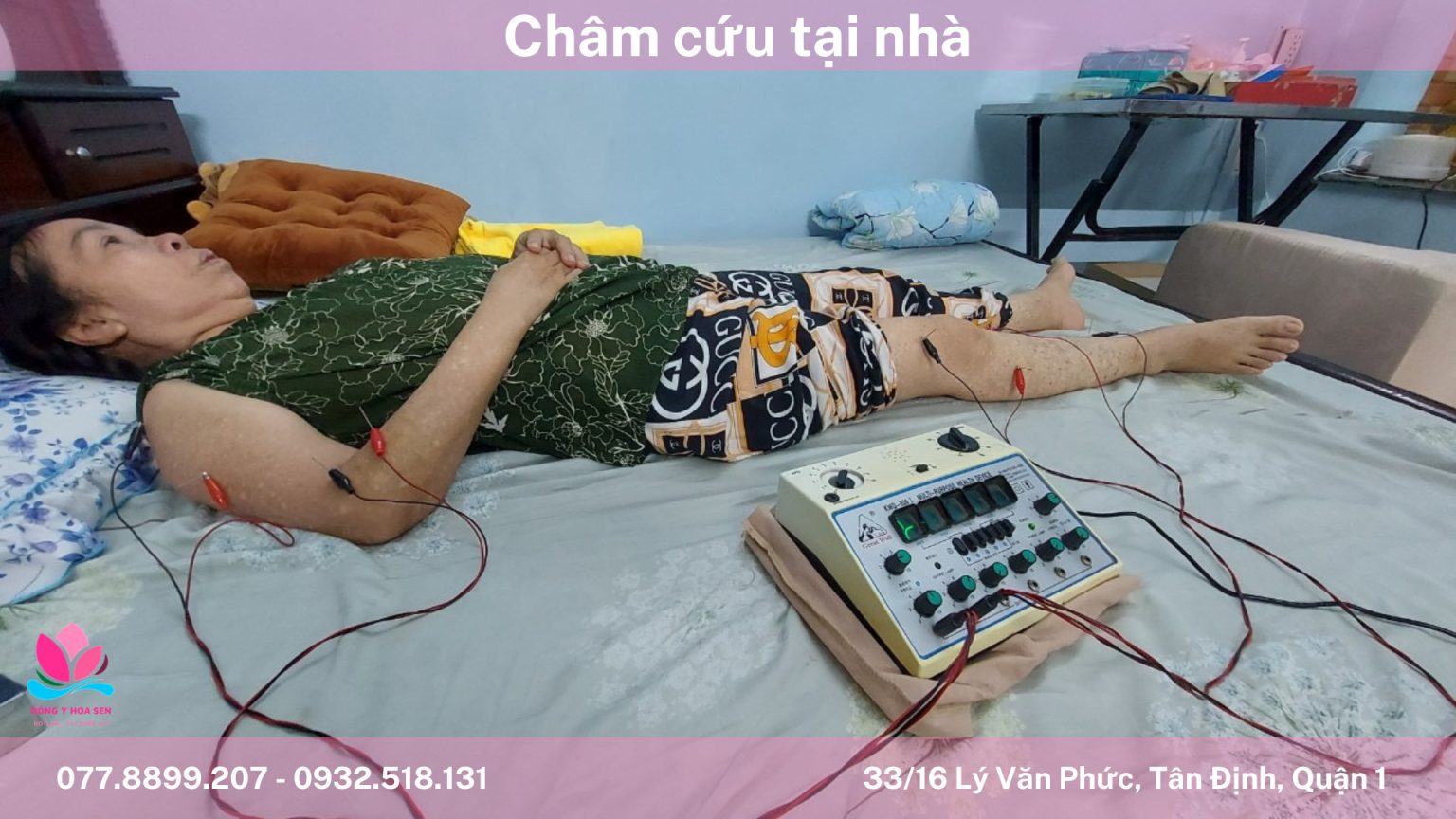 Châm cứu chữa mất ngủ